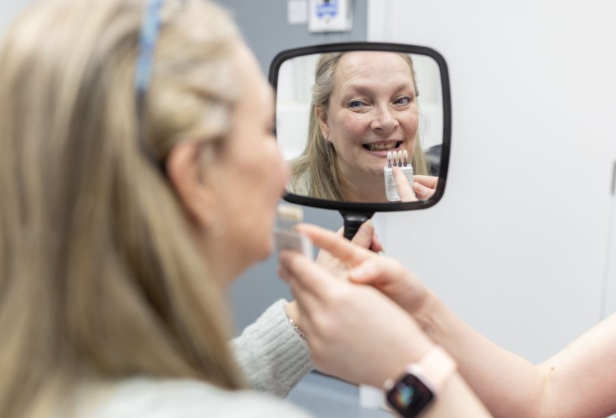 Why have dental veneers? image