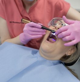 Composite Bonding