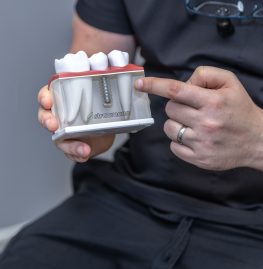 Dental Implants
