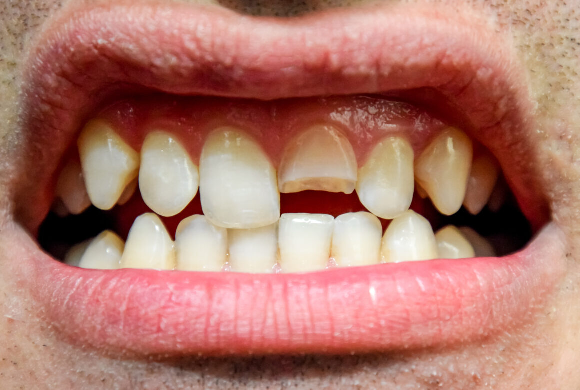 What is a dental emergency? image