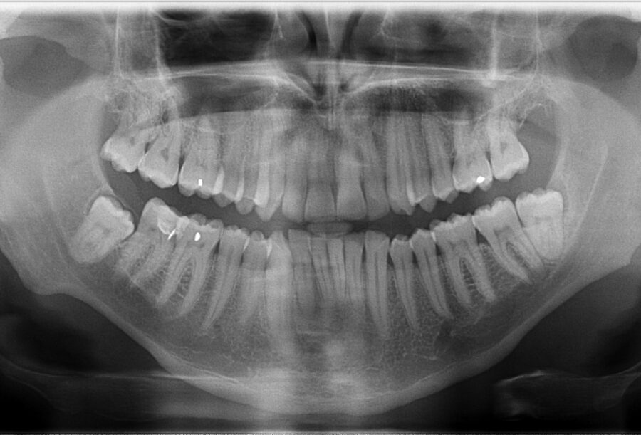 What does emergency dentistry at Smilestyle involve? image