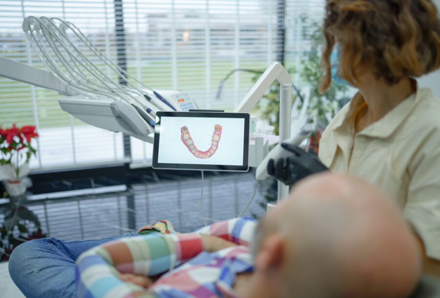 iTero 3D scanner image