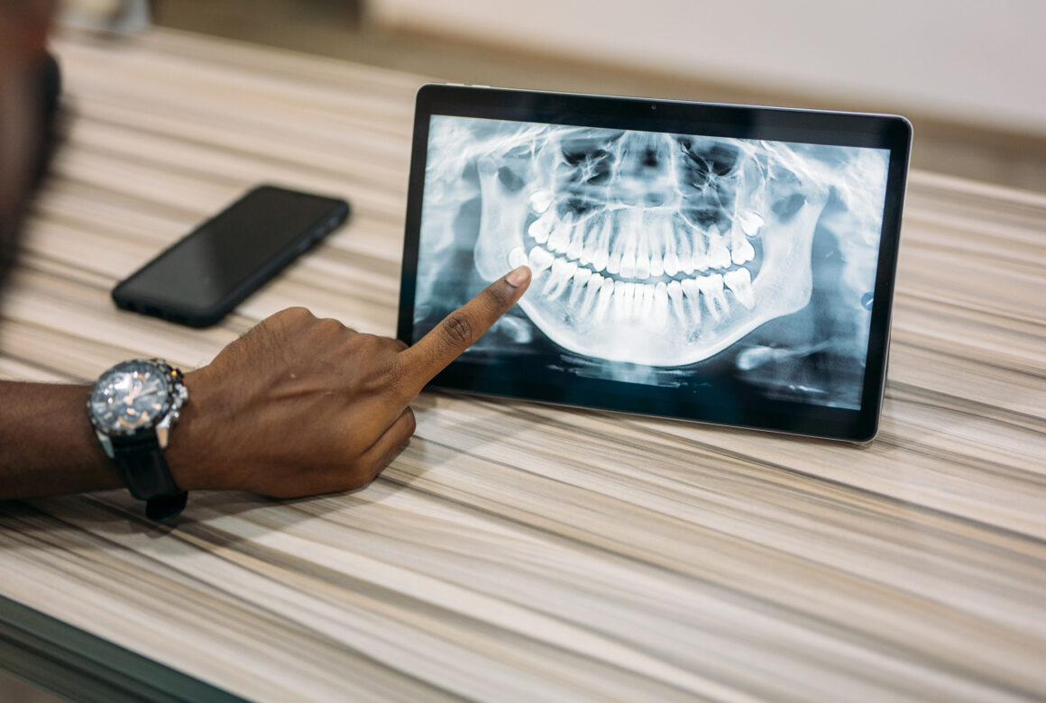 Digital X-rays image