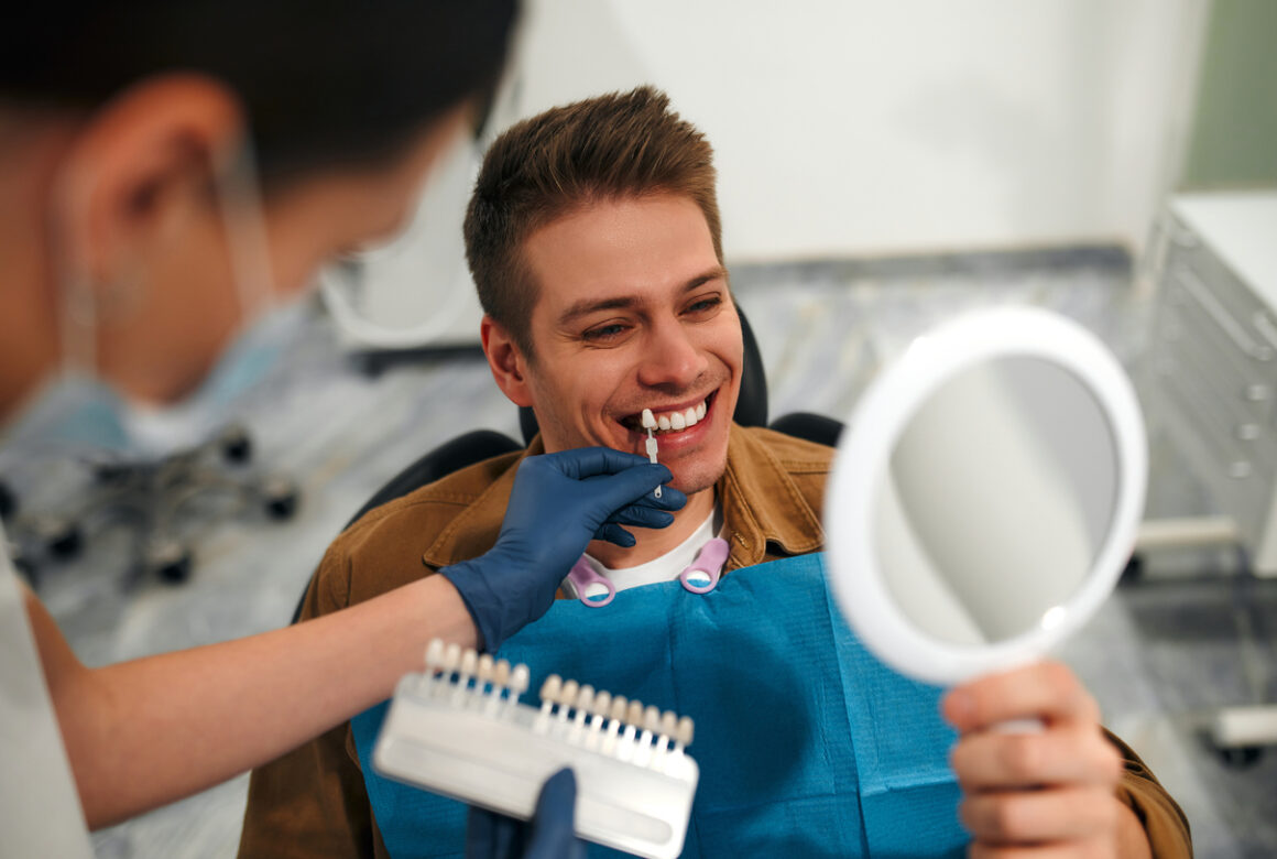 What are veneers?